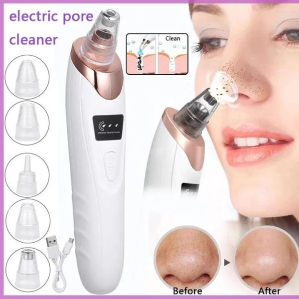 Face Vacuum Suction Blackhead Remover | Electric Pore Cleaner & Deep Cleansing Tool